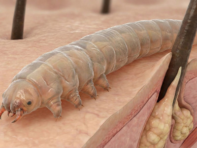 Чим лікувати демодекс? Ефективна стратегія відновлення шкіри