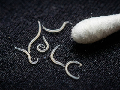 Гострики: як позбутися паразитів? Ефективна програма очищення