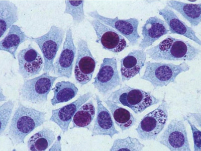 Чим лікувати хламідіоз? Ефективна стратегія відновлення