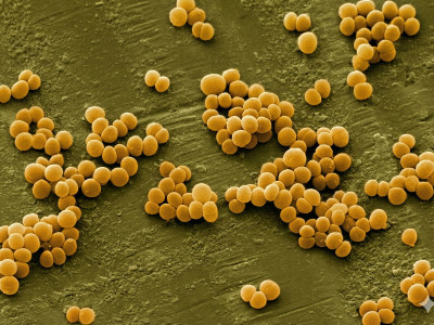 Як очистити організм від стафілококу? Ефективна стратегія відновлення