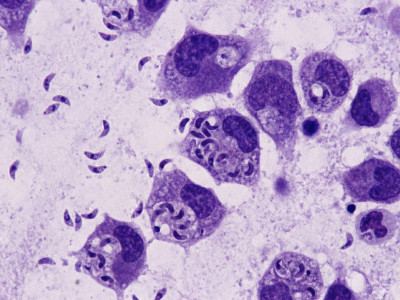 Чим лікувати токсоплазмоз? Ефективна стратегія відновлення